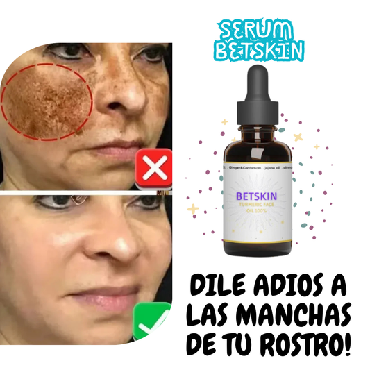 Serum Correcto De Manchas Betskin